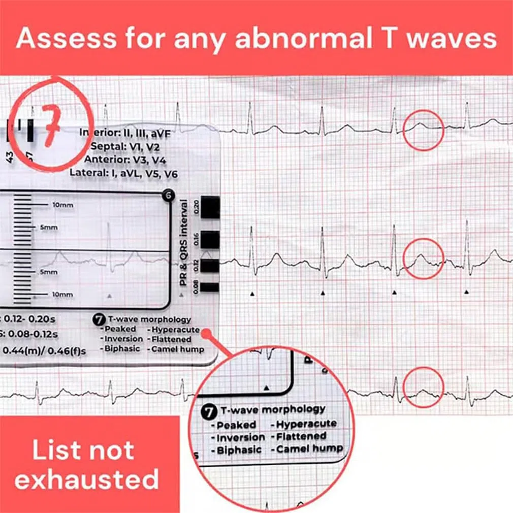 2 sztuki linijki EKG z 7 krokami, karta linijki EKG przezroczyste narzędzie pomiarowe EKG, 7-stopniowa interpretacja EKG/EKG, narzędzie pomiarowe dla rodzin, studentów, ratowników medycznych