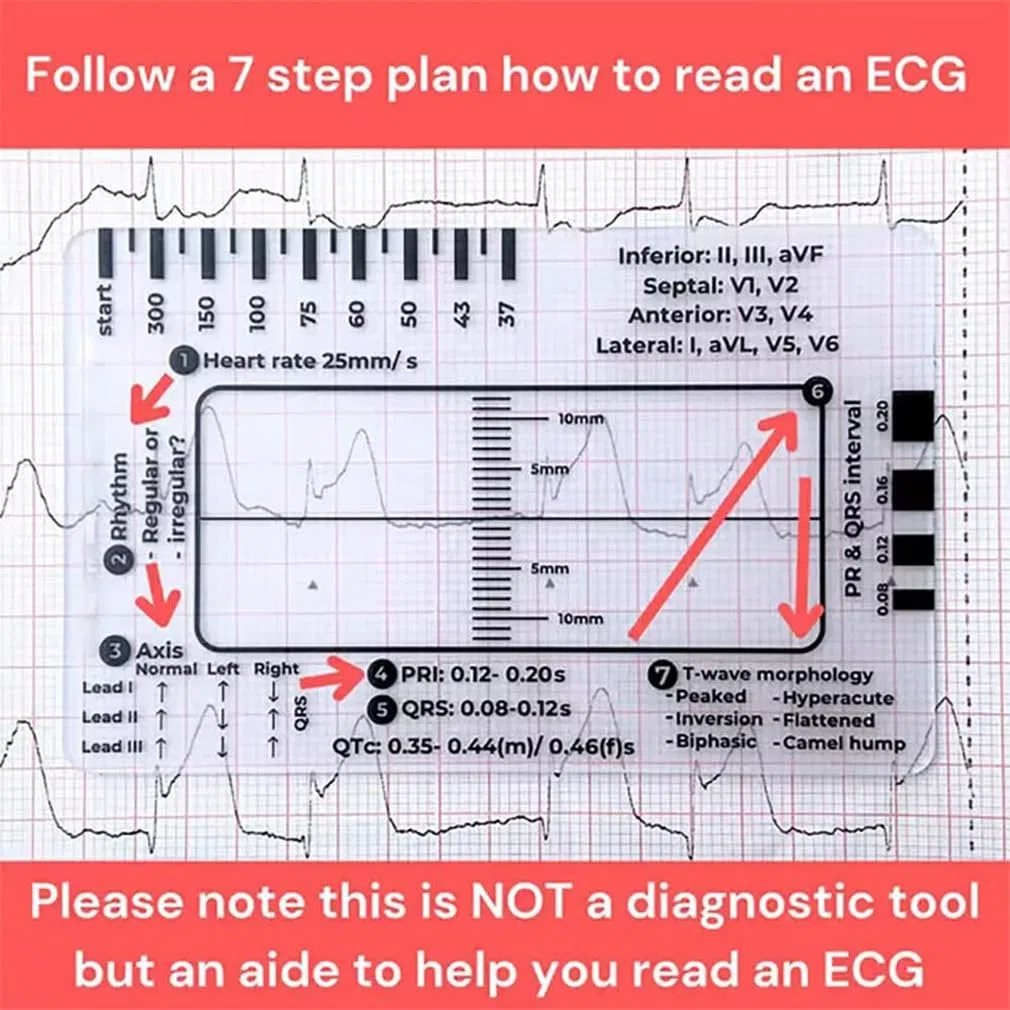 2 sztuki linijki EKG z 7 krokami, karta linijki EKG przezroczyste narzędzie pomiarowe EKG, 7-stopniowa interpretacja EKG/EKG, narzędzie pomiarowe dla rodzin, studentów, ratowników medycznych